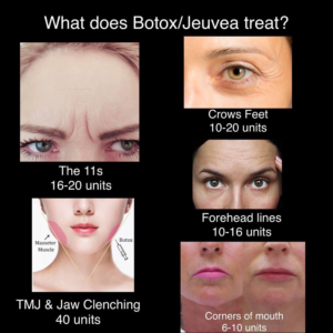 Botox Before & After | The Skin Clinic MedSpa | Mankato