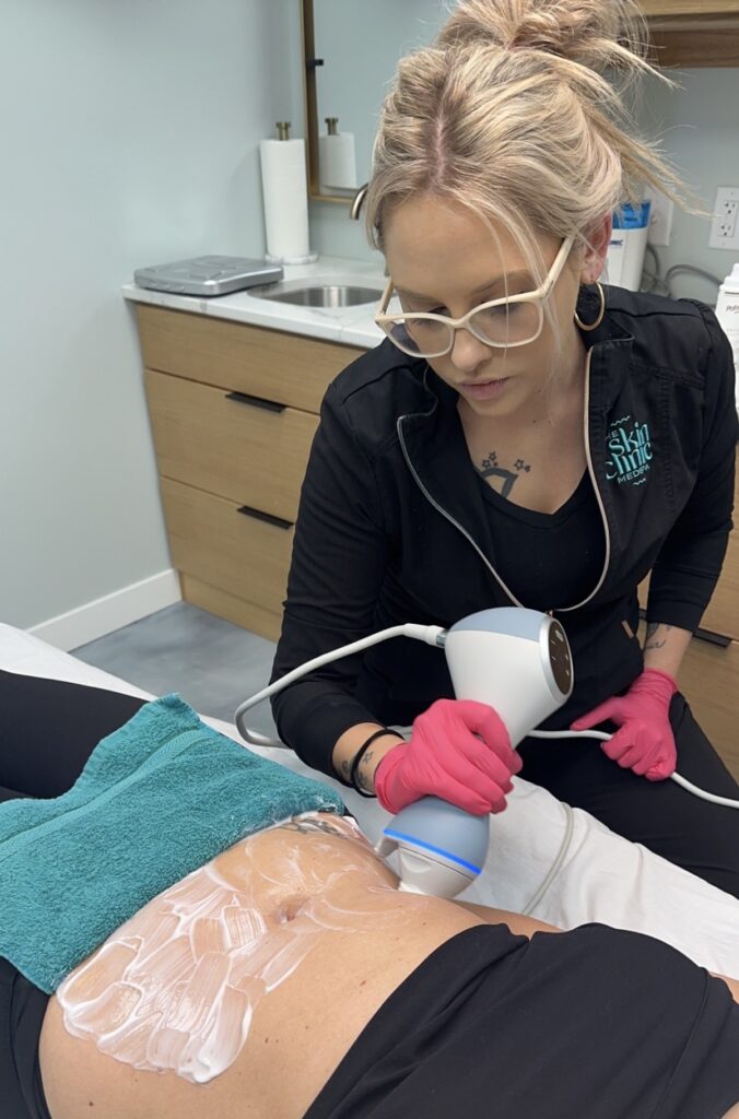 Skin Tightening treatments in Mankato, MN