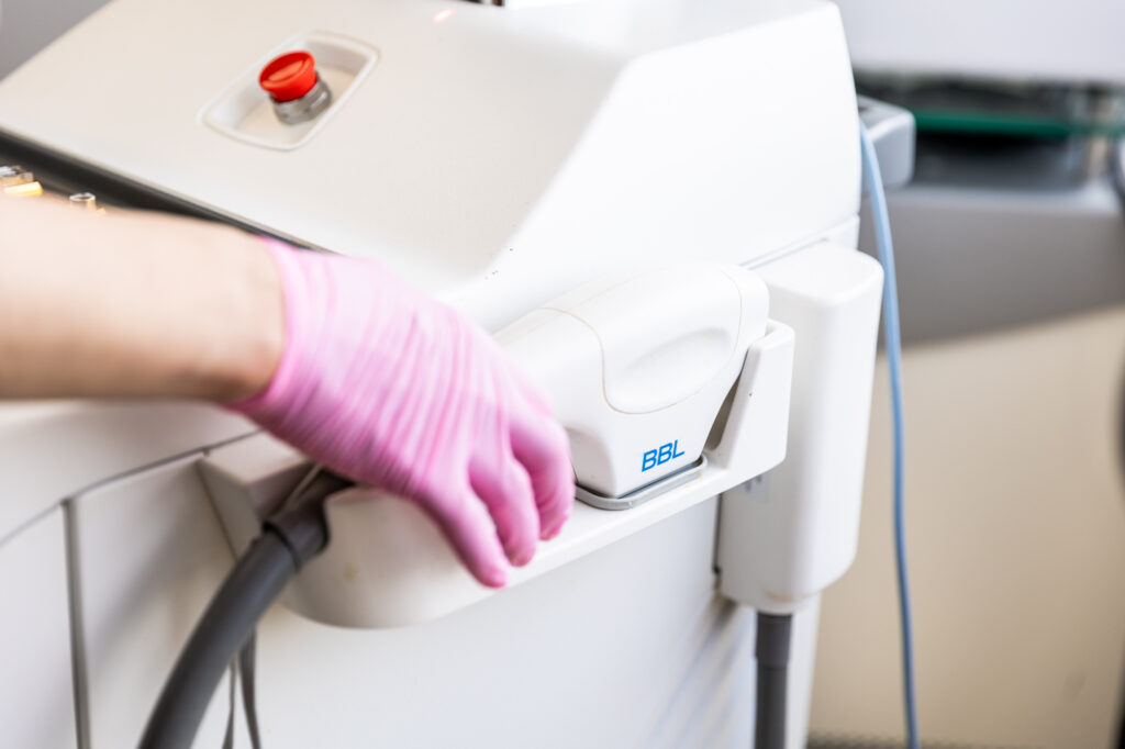 The device used for intense pulsed light near Fairmont, MN, at The Skin Clinic. A provider's hand, wearing a surgical glove, reaches for the hand-held portion of the device that is used to deliver the treatment.