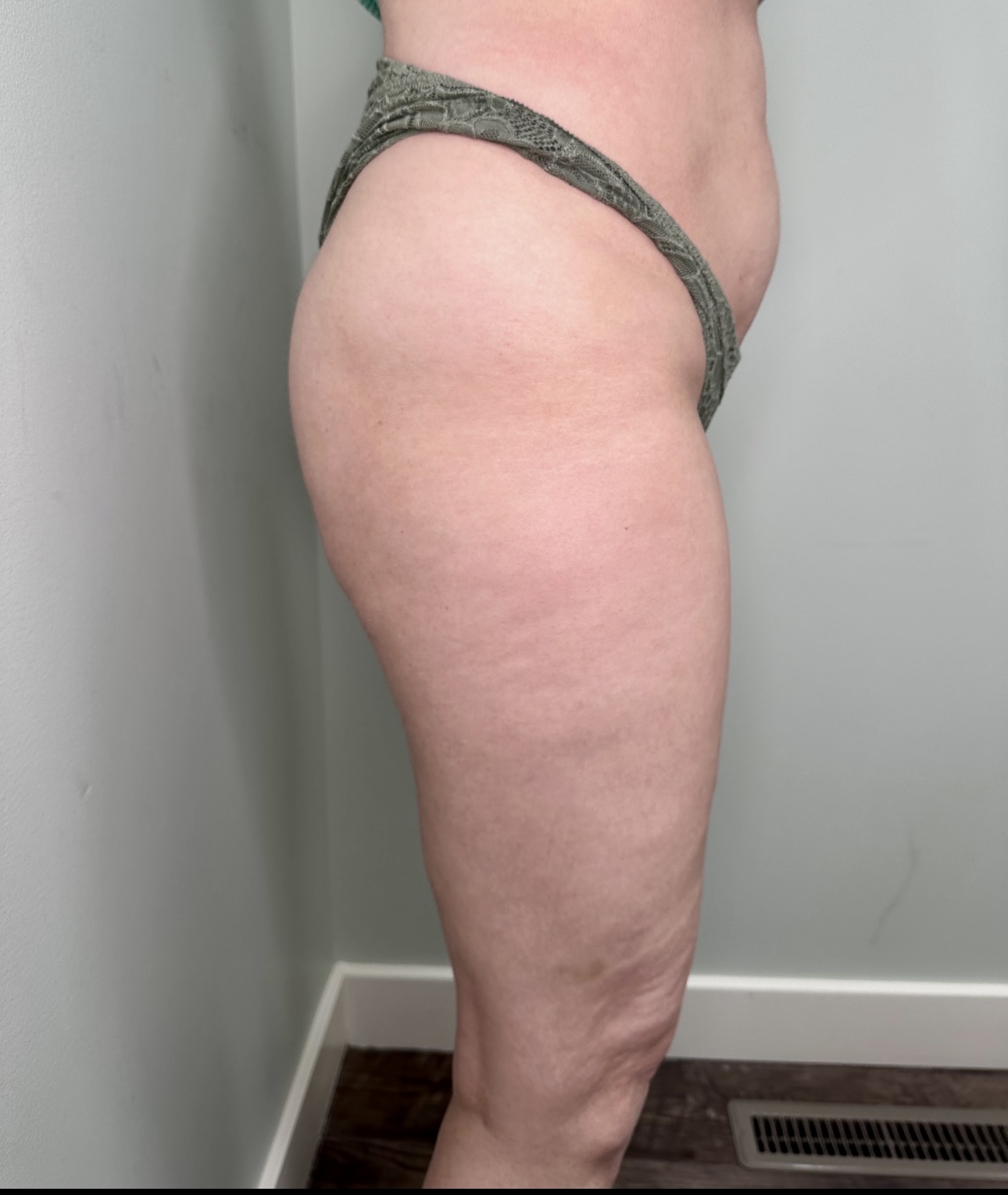 Get stronger, leaner, and more toned with EMSCULPT NEO. FDA-cleared, no downtime, just powerful body contouring.