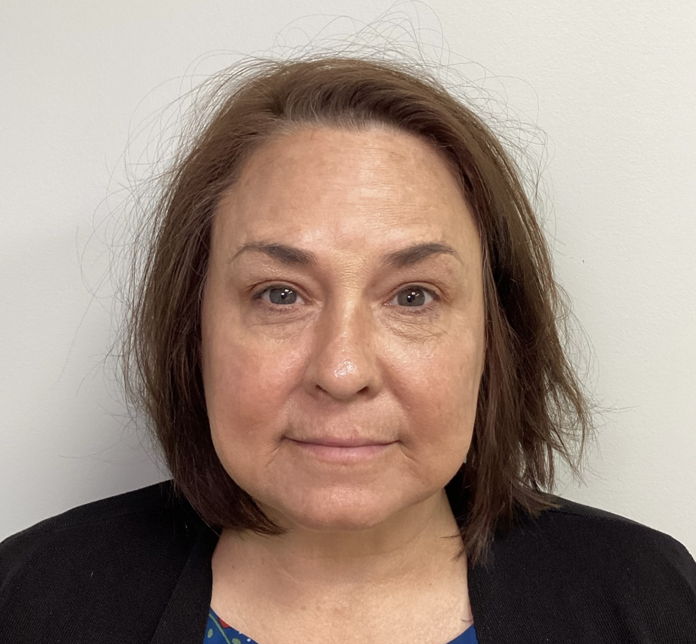 Rejuvenate your skin with IPL Photofacials. A safe, effective treatment for discoloration, sun damage, and signs of aging