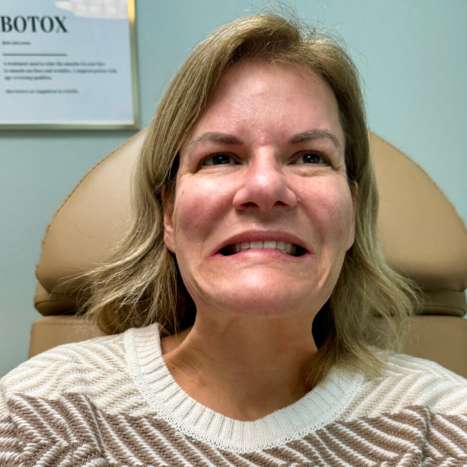 Botox Treatment Neck