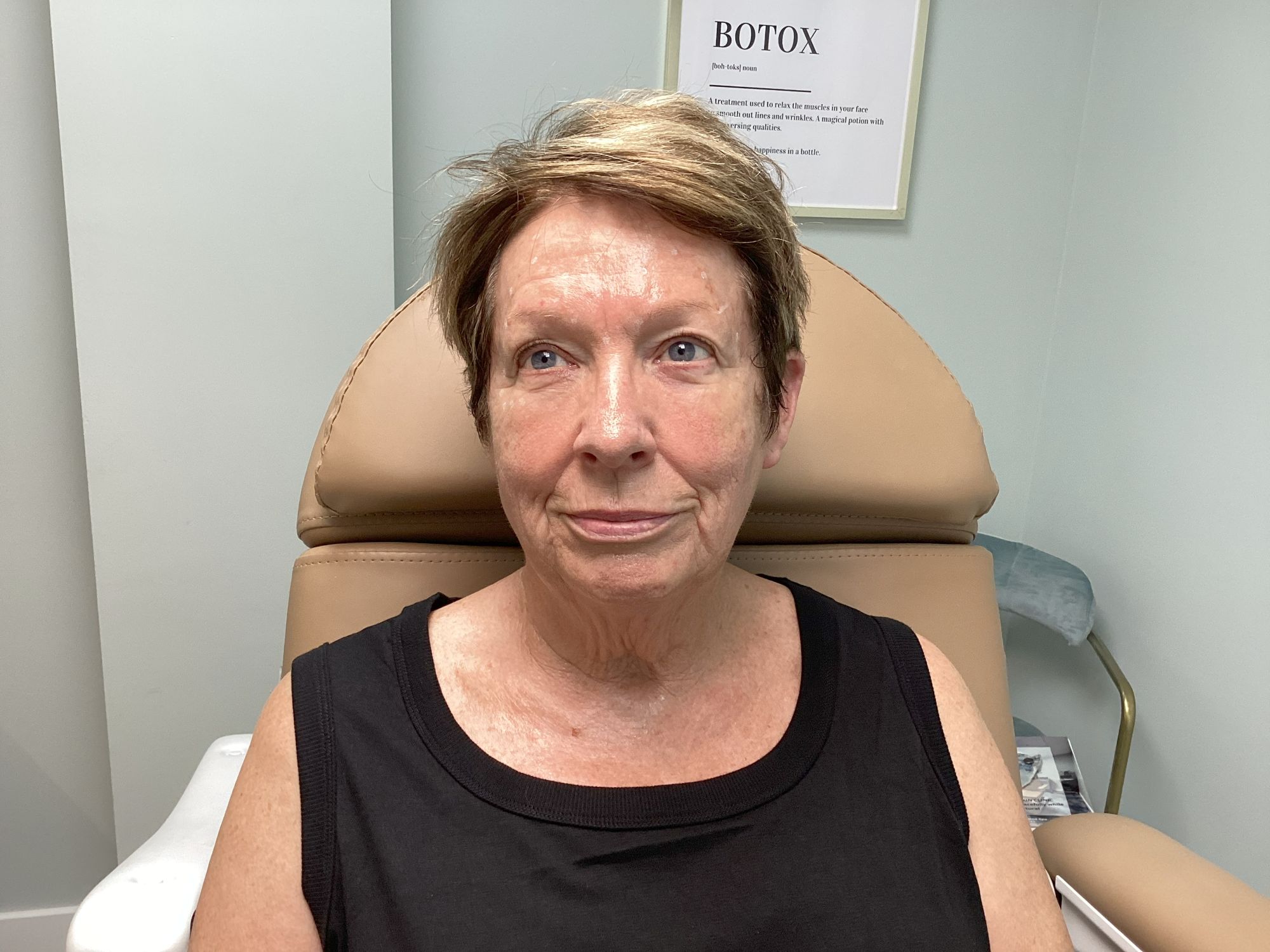 Smooth fine lines, refresh your appearance, and restore confidence with our advanced wrinkle-relaxing treatments—customized just for you.