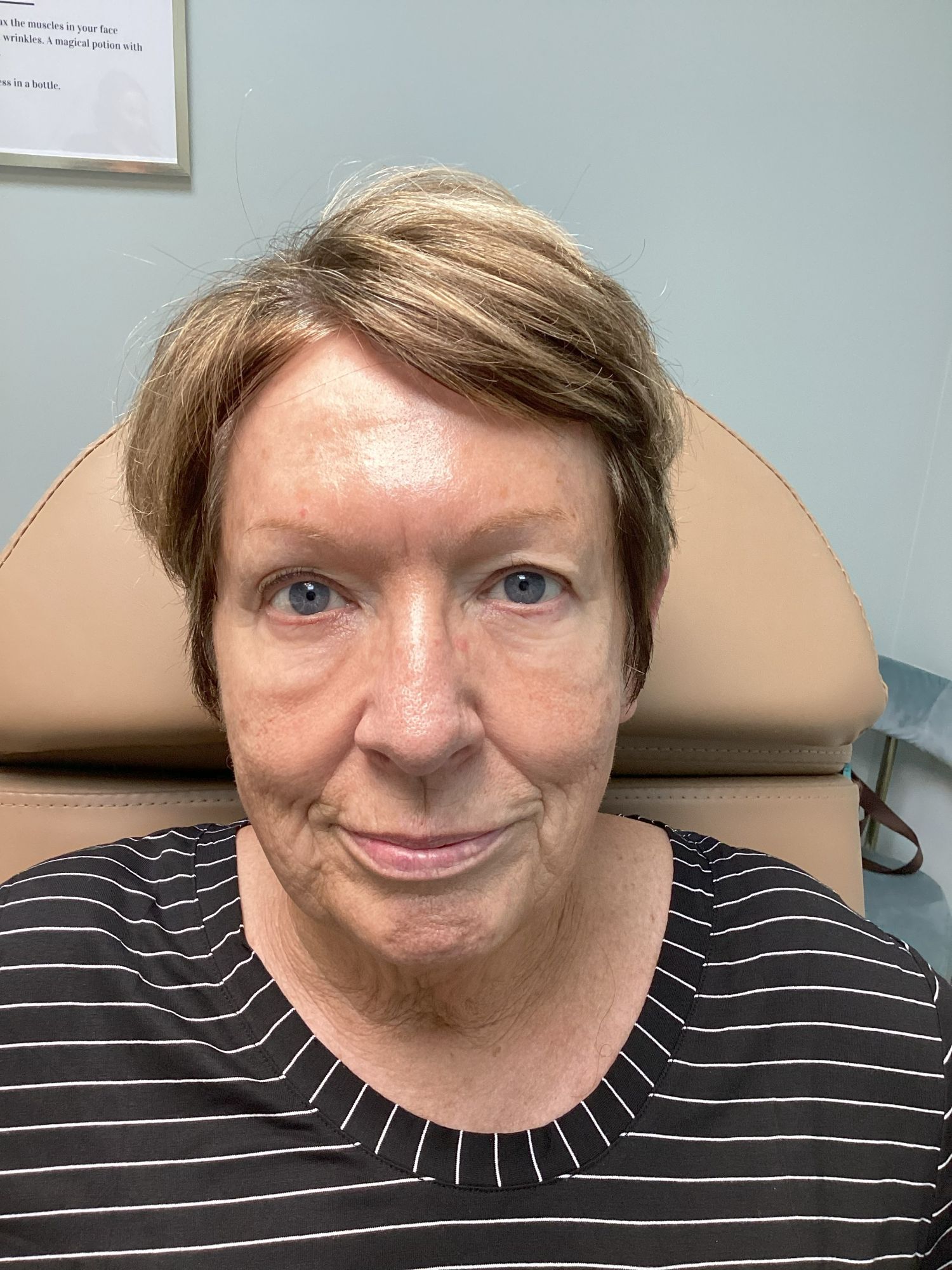 Smooth fine lines, refresh your appearance, and restore confidence with our advanced wrinkle-relaxing treatments—customized just for you.