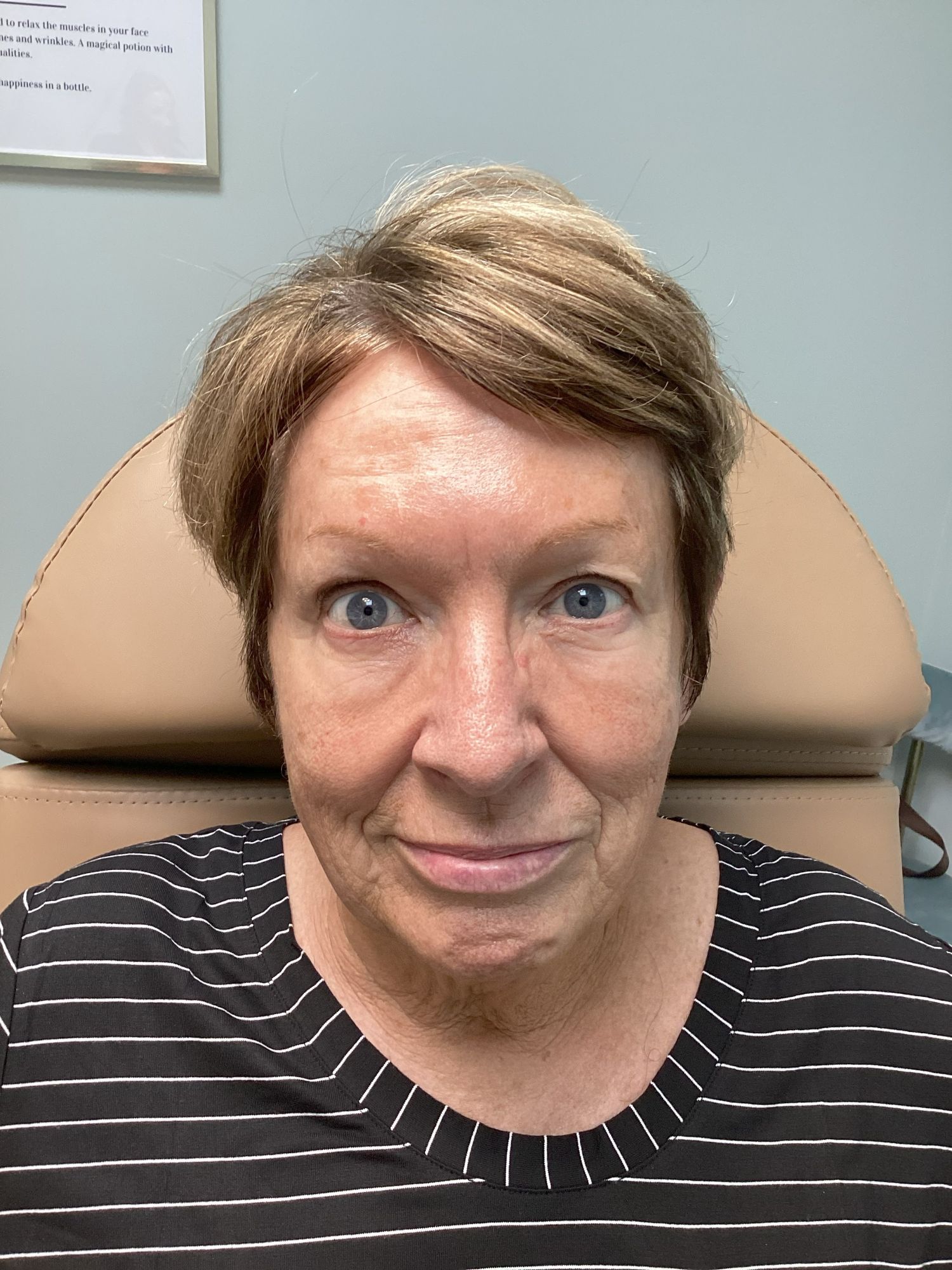 Smooth fine lines, refresh your appearance, and restore confidence with our advanced wrinkle-relaxing treatments—customized just for you.