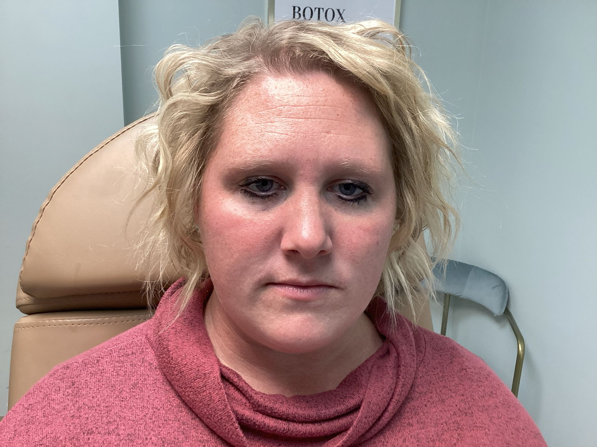 Smooth fine lines, refresh your appearance, and restore confidence with our advanced wrinkle-relaxing treatments—customized just for you with Botox