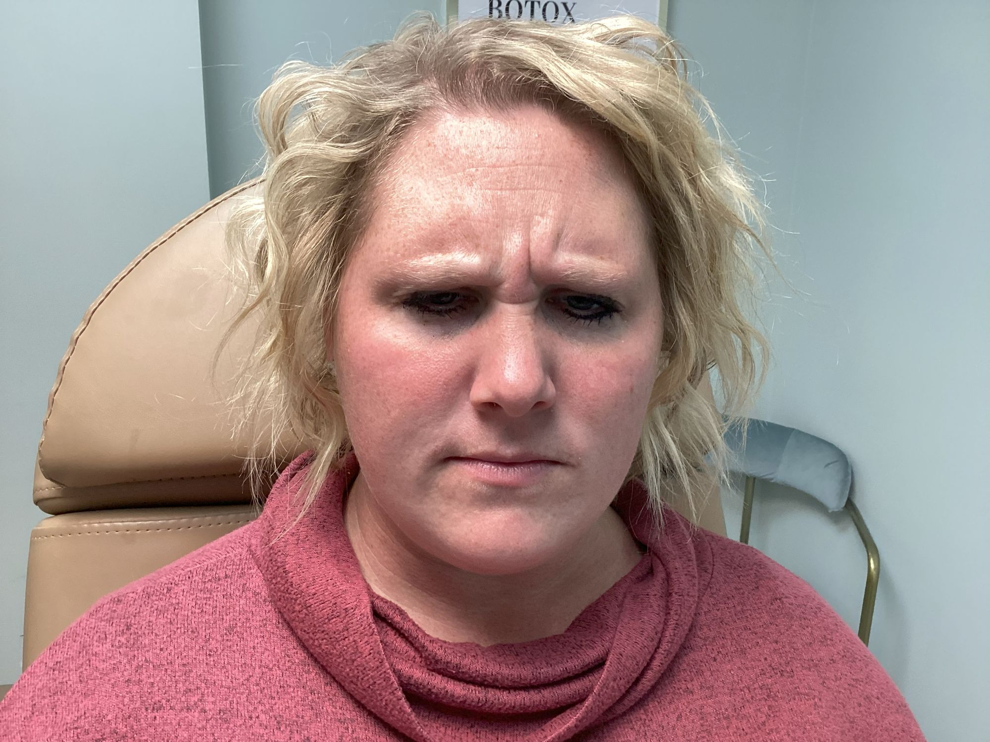 Botox treatment