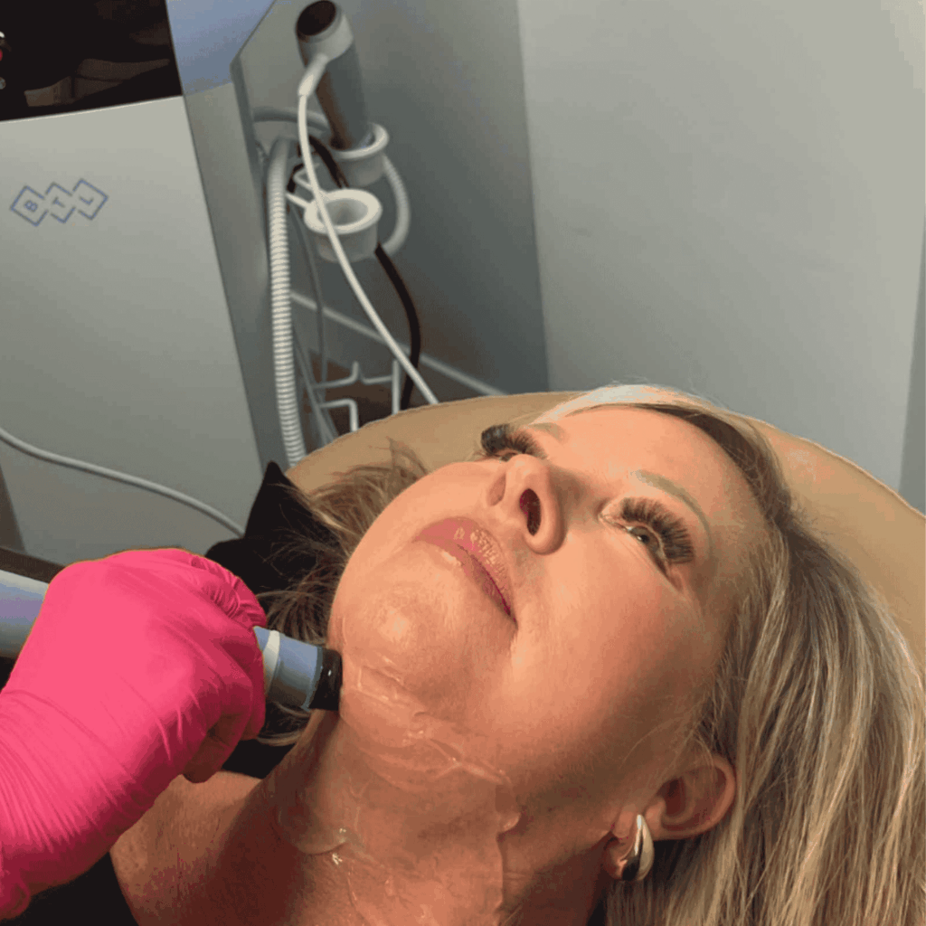 Exion Face Skin Tightening Mankato Mn